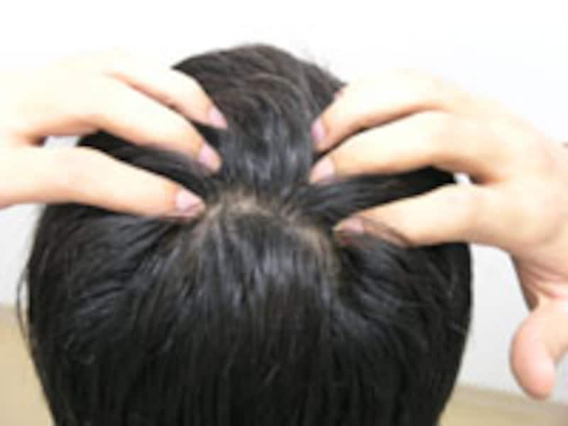 頭皮は健康?