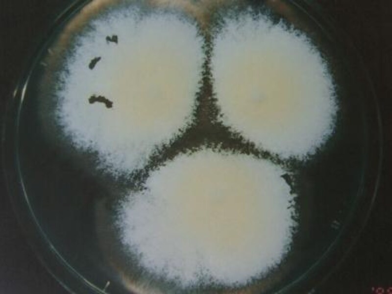 暖冬の影響 水虫注意報発令 皮膚 爪 髪の病気 All About 暖冬の影響 水虫注意報発令 皮膚 爪 髪の病気 All About