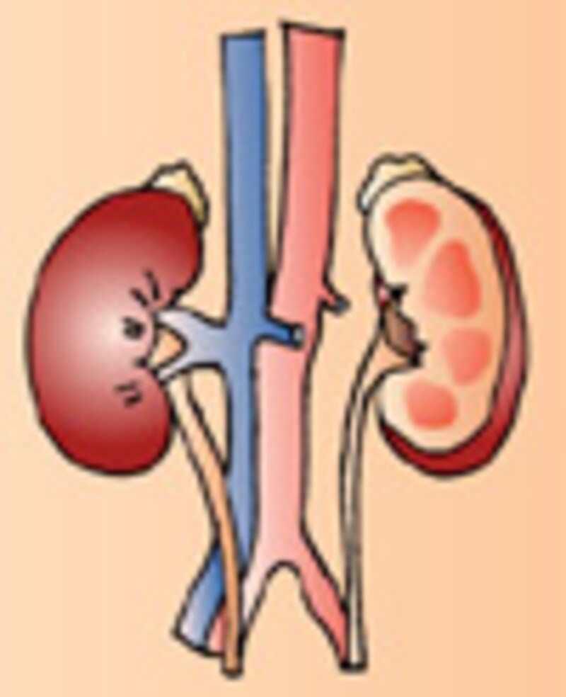 kidney