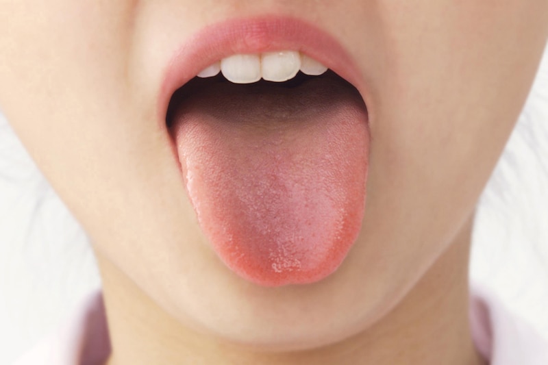 口腔アレルギー症候群とは 治療と対策 アレルギー All About