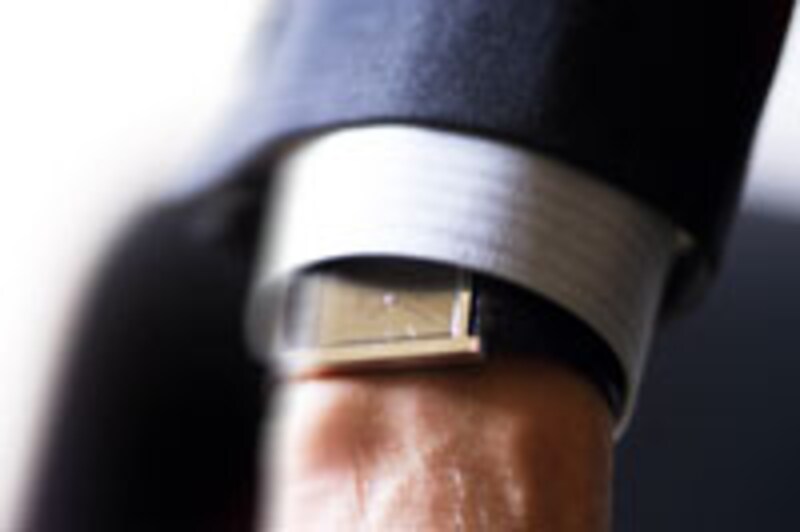 なめし皮でも起こる金属アレルギー