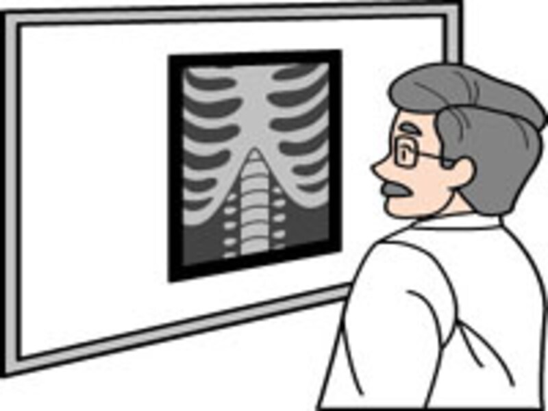 放射線治療の位置づけ