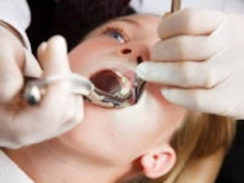 血をサラサラにするような薬、骨粗鬆症の薬を服用している場合は、必ず抜歯前に伝えること