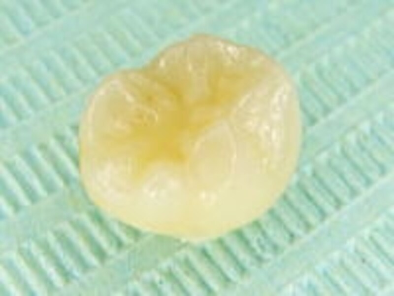 理想的な状況で抜けた乳歯、永久歯の虫歯リスクはほとんどなし