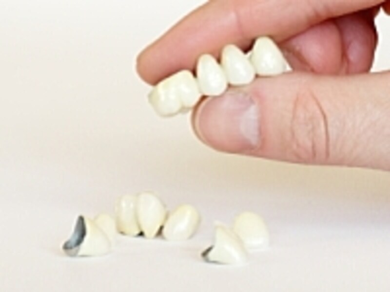 保険の白い歯は樹脂系、保険が利かない白い歯は主にセラミック系が多い