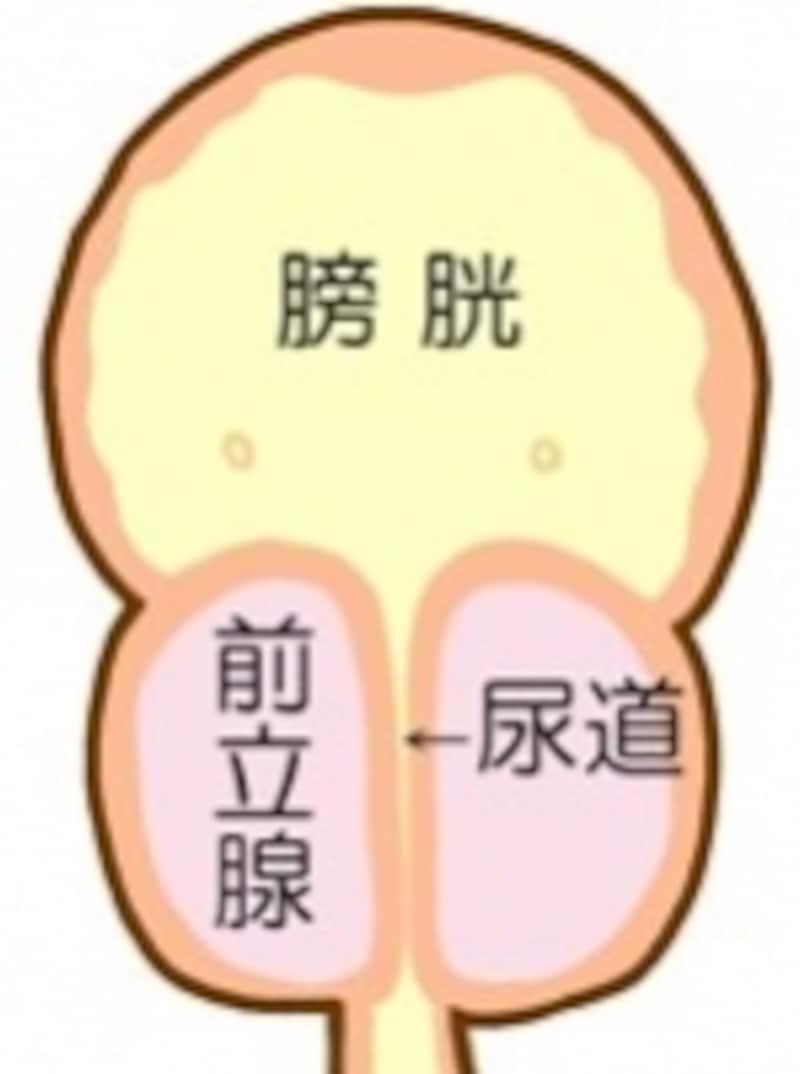 前立腺が大きくなると、過剰な収縮によって尿道を圧迫する