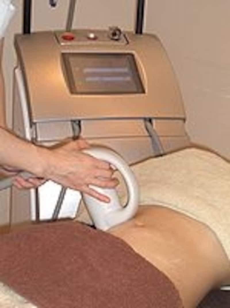 アクセントウルトラ