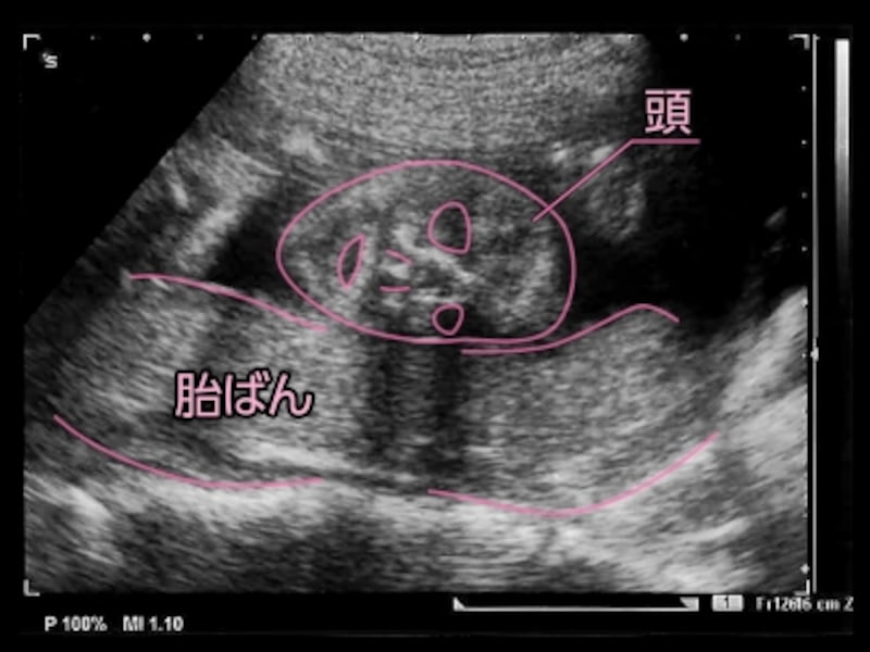 妊娠22週 エコー写真で見る胎児の大きさ 胎動 22週の壁とは 妊娠中期 All About