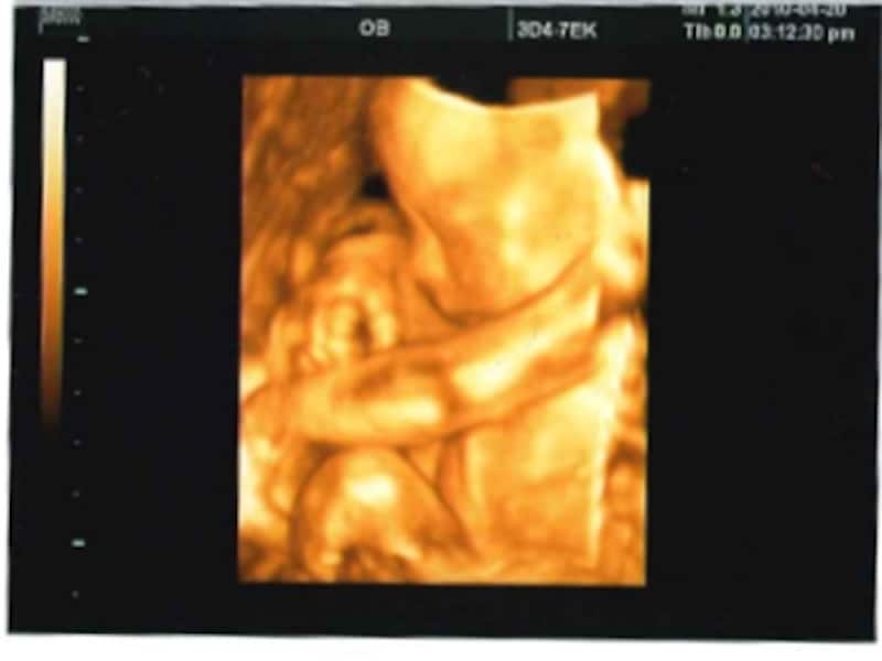 妊娠23週目エコー写真 胎動の様子 胎児の大きさや体重 妊娠中期 All About