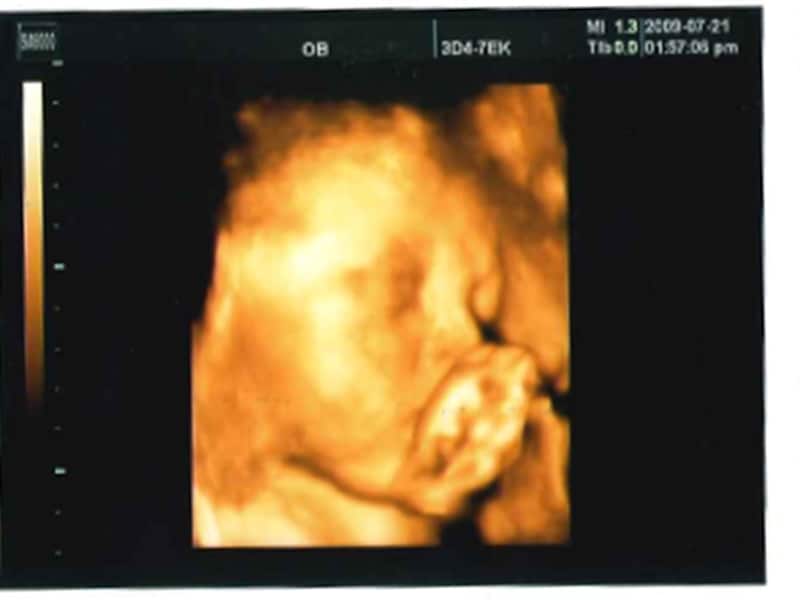 妊娠28週目（28w,二十八週）の胎児のエコー写真・超音波写真