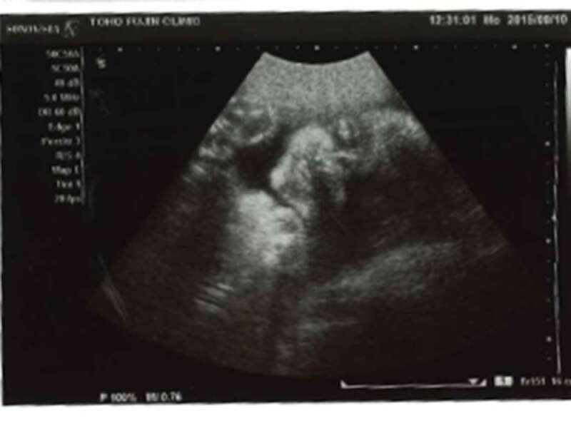 妊娠29週目（29w,妊娠二十九週）胎児のエコー写真・超音波写真