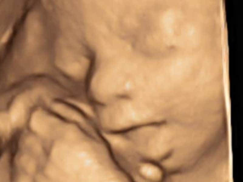 妊娠34週目,34w,妊娠三十四週,34w0d,34w1d,34w2d,34w3d,34w4d,34w5d,34w6d　胎児の表情