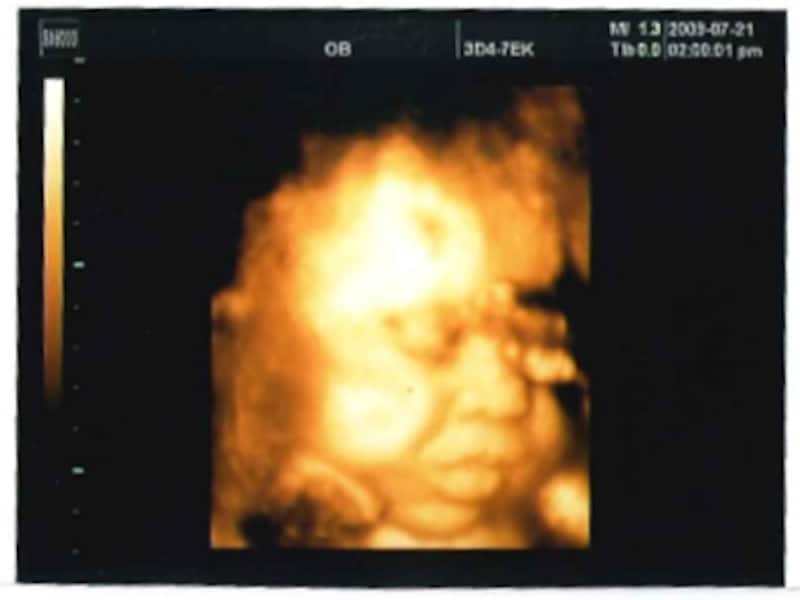 妊娠36週目,36w,妊娠三十六週の胎児のエコー写真・超音波写真