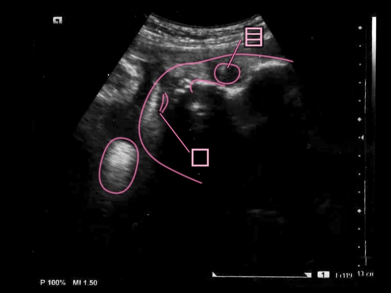 妊娠39週,39w,妊娠三十九週　胎児のエコー写真・超音波写真