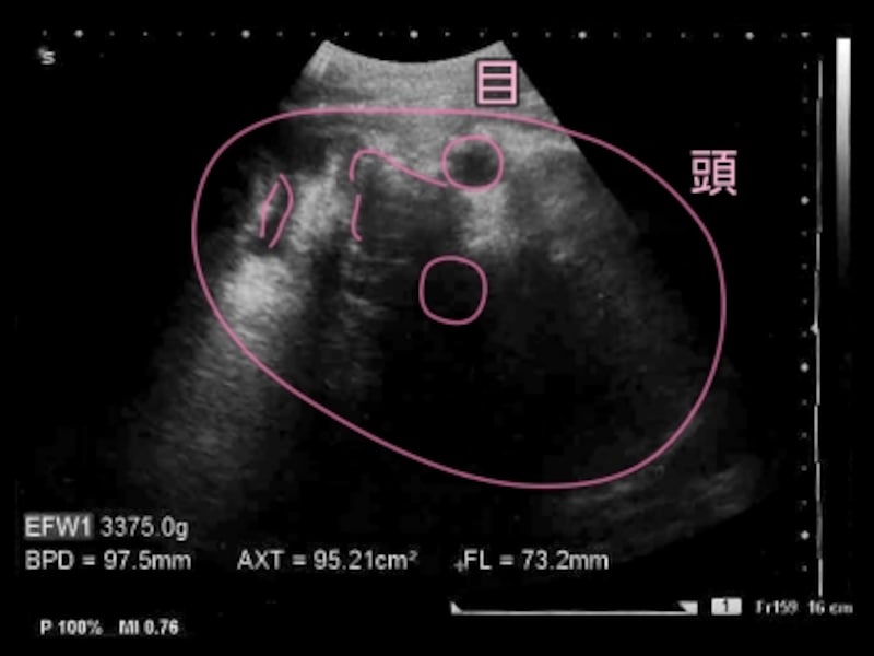 妊娠40週目 胎児の大きさ エコー写真と妊婦の注意点 妊娠後期 All About