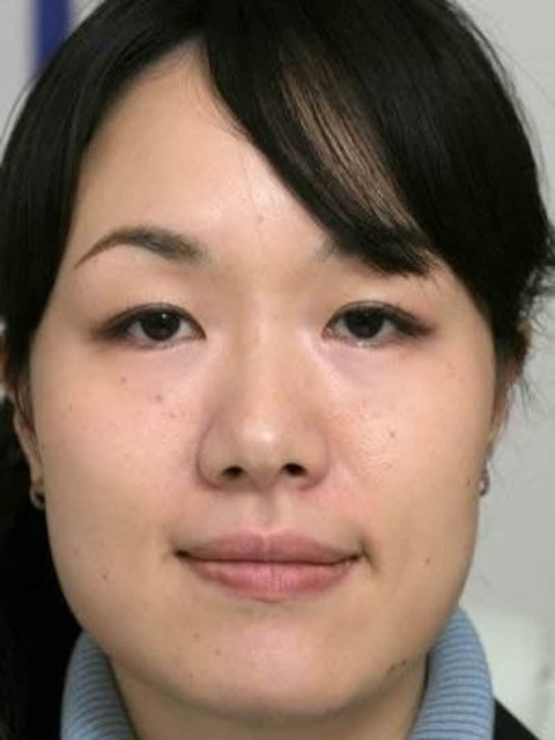Tさんアフター画像