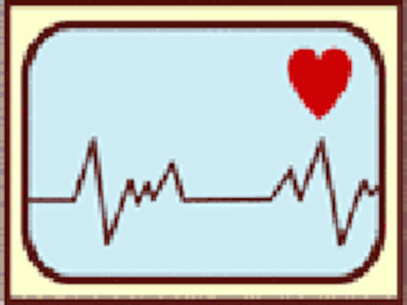 心電図、血圧計、血圧測定、麻酔、高血圧、低血圧