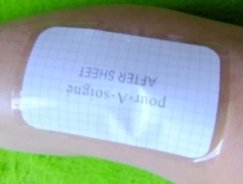 プラソニエ エピルーズEXαundefinedアフターシール使用時