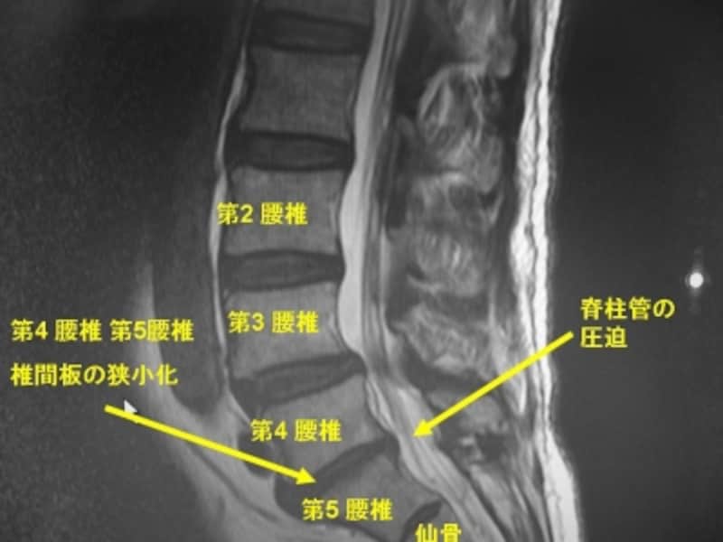 MRI