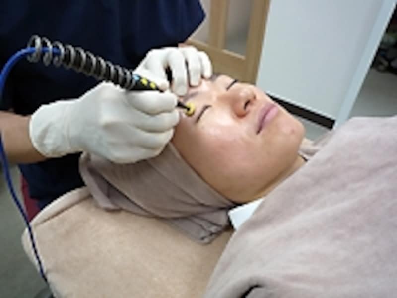 ラディエイジ４