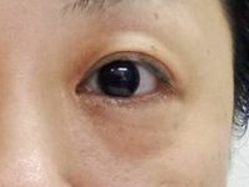 アフター