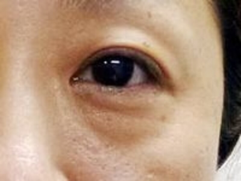 ビフォア