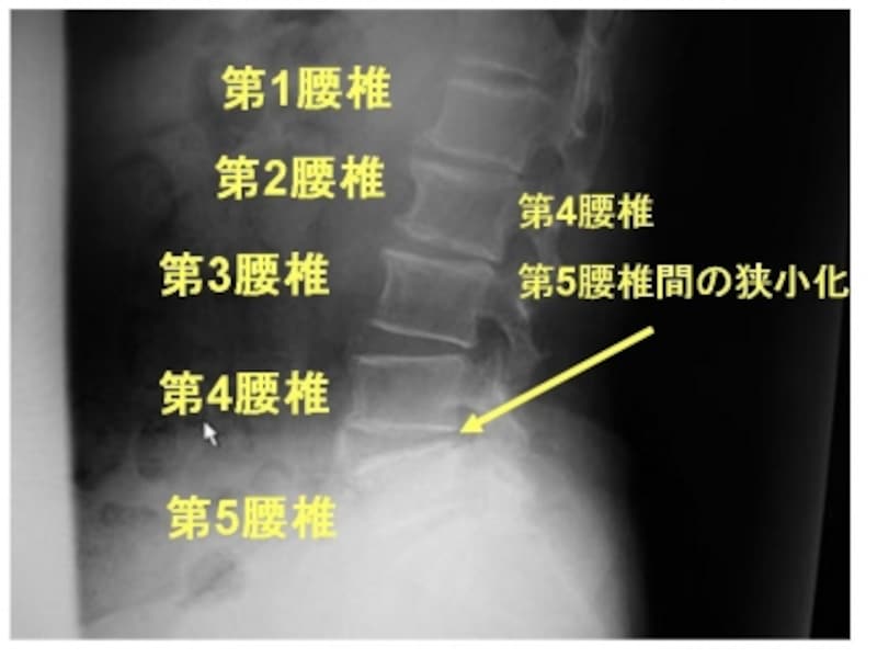 単純X線