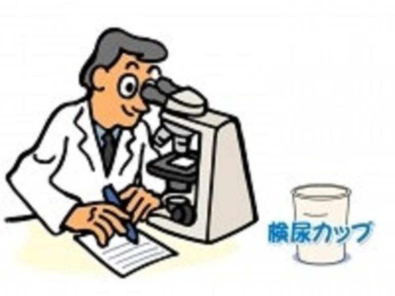 尿検査が重要になってきます
