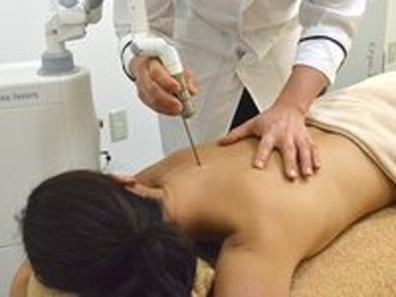 背中の脱色レーザー