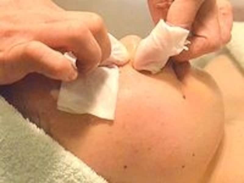 エクストラクション