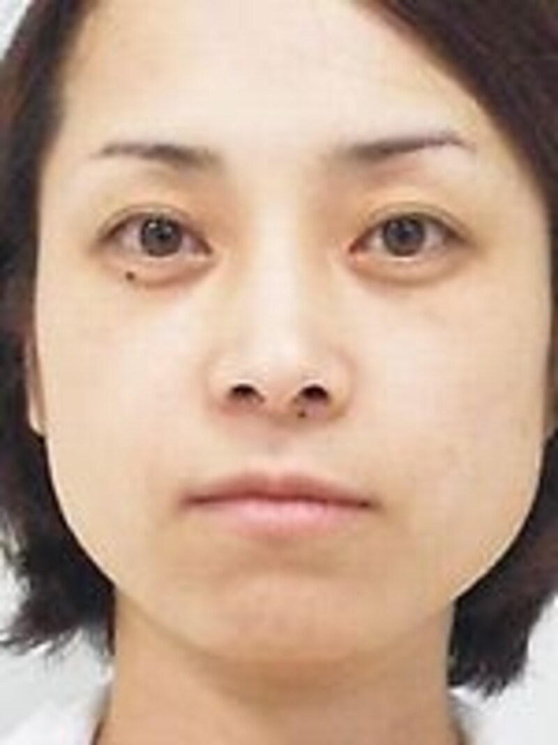 ビフォア