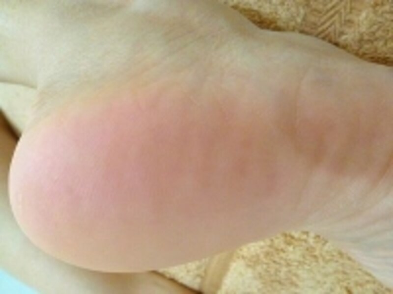 もちもちかかと