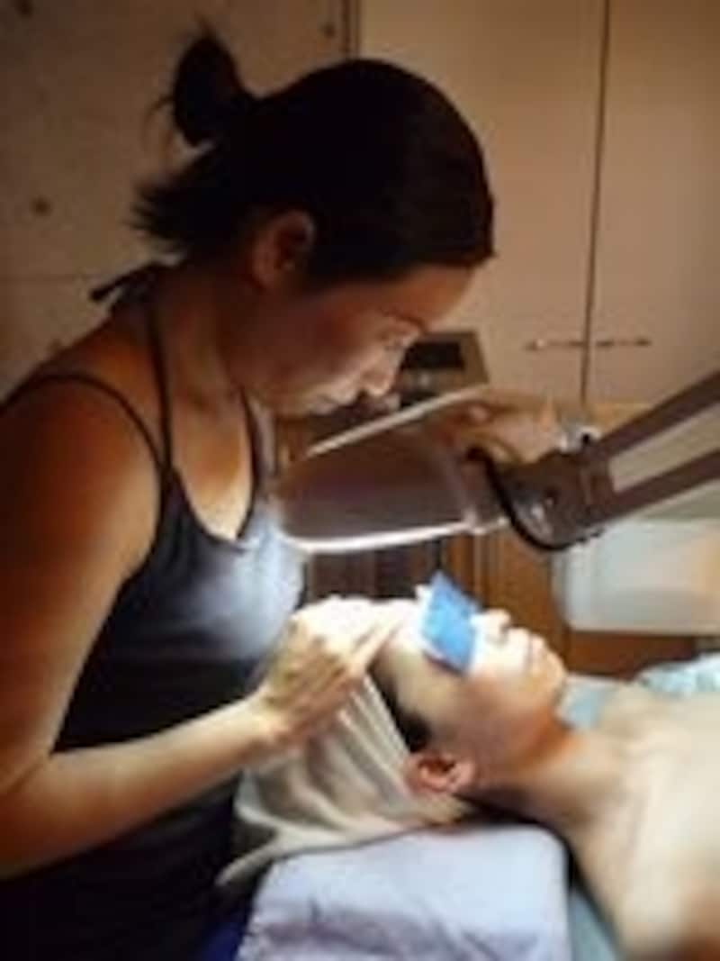 スキンチェック