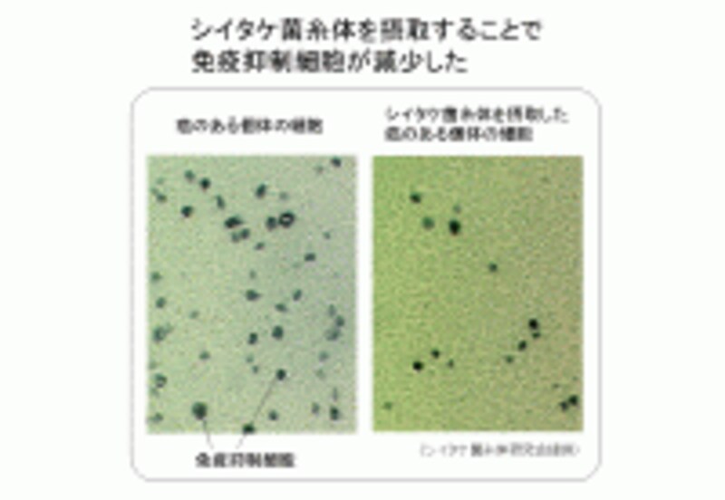 シイタケ菌糸体と免疫抑制細