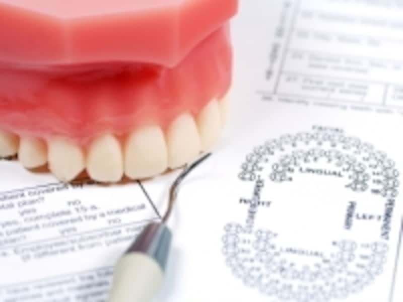 歯の検査