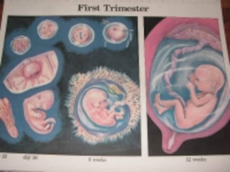 つわりを落ち着かせる方法