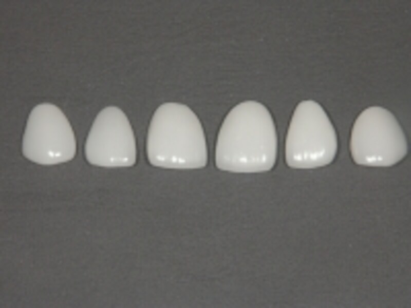 ラミネートベニアの治療に使います