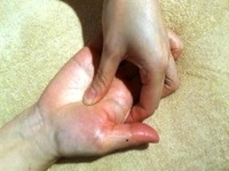 親指を使って、きゅっと圧迫