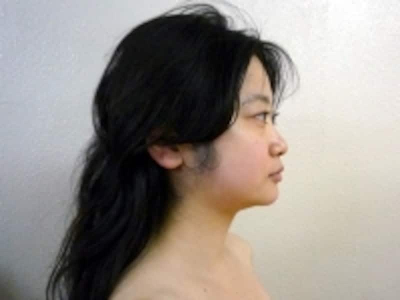 横向きアフター