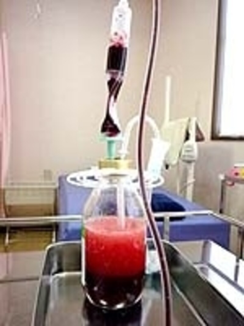 オゾン化された血液