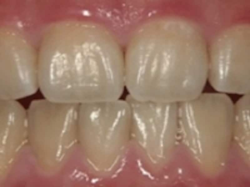 表面の汚れをオフ！