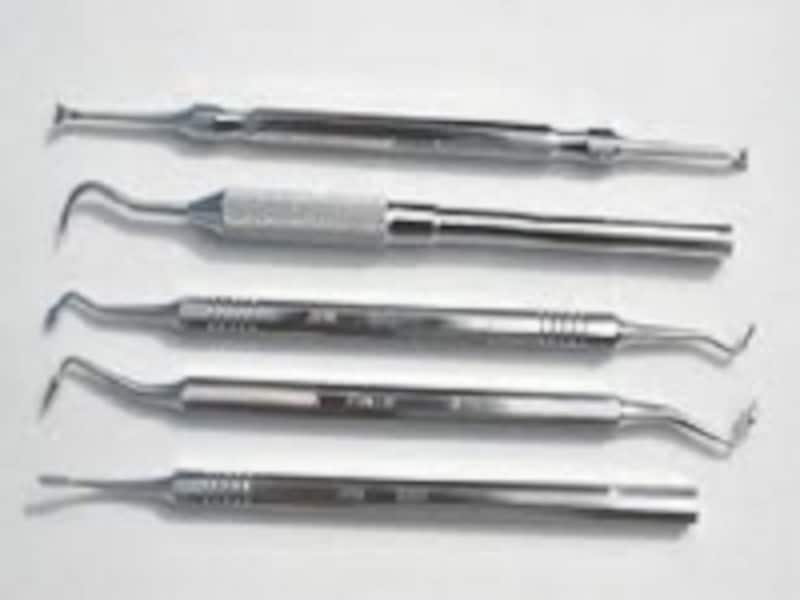 スケーラーで細かい歯石も除去！