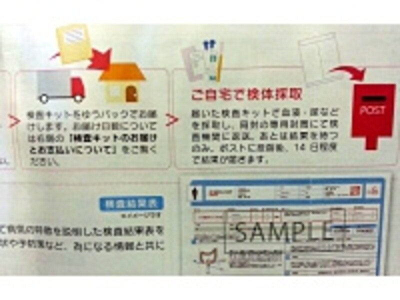 郵送検査