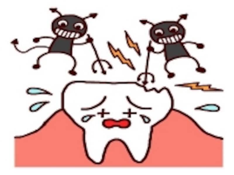 虫歯は悪臭のもと!