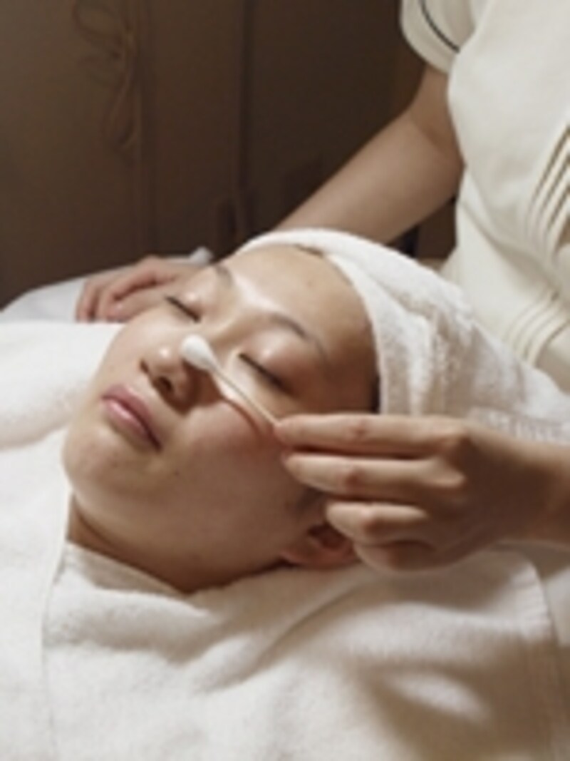 ケミカルピーリング