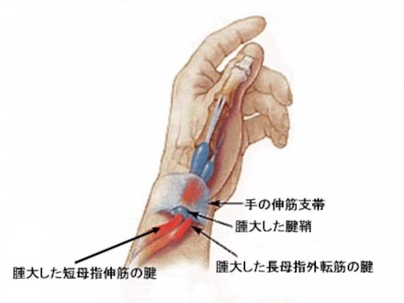 フィンケルシュタイン テストはどのように実行されますか?