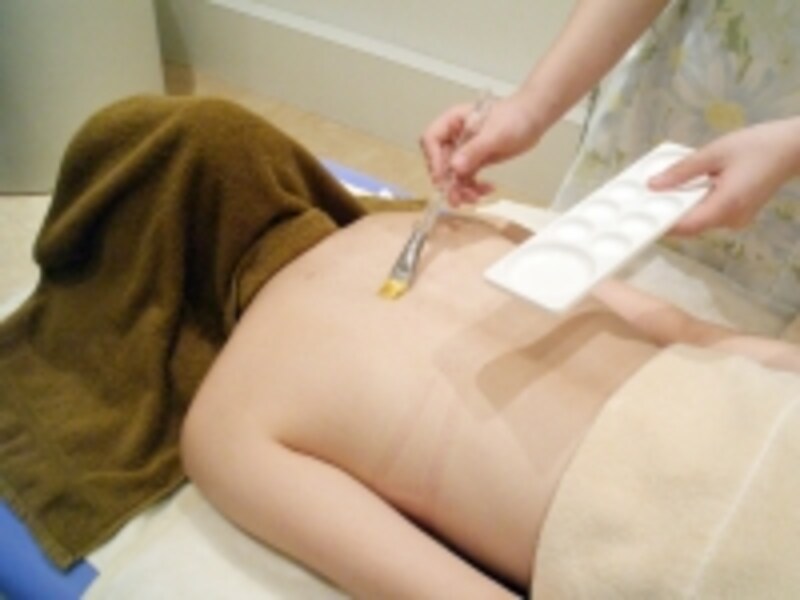 ケミカルピーリング