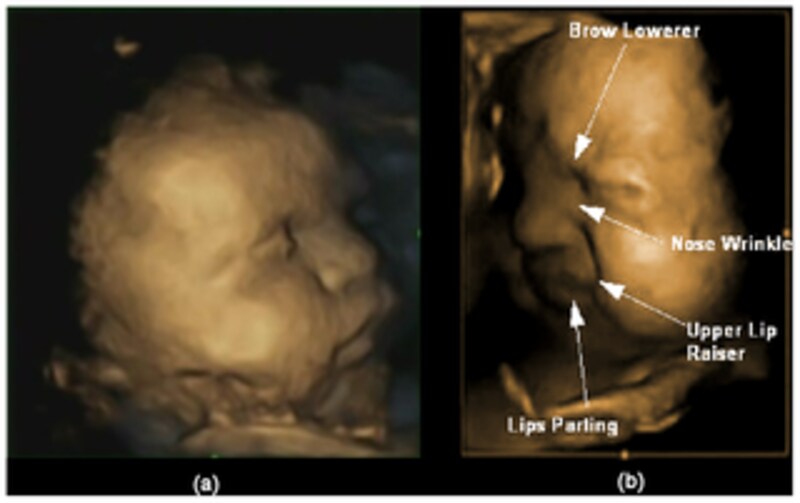 妊娠32週の赤ちゃんundefinedより複雑な表情が出来るようになってきているのがこの時期(*)