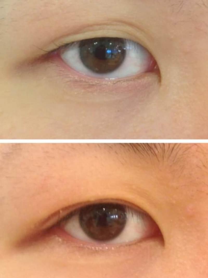 アイプチの代用で二重まぶたを作る！