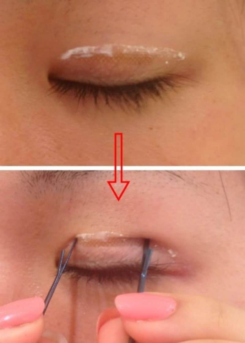 アイプチの代用で二重まぶたを作る！